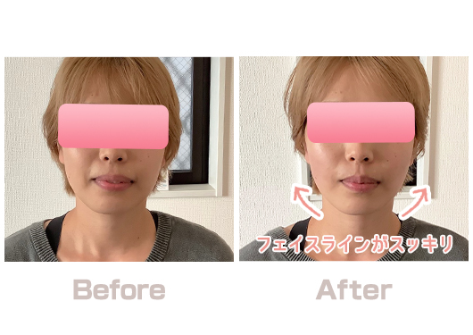 BA③