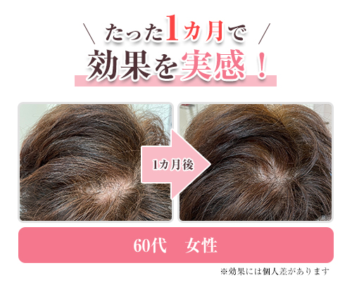 育毛①