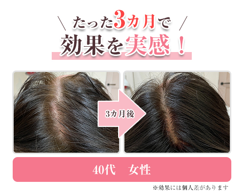 育毛②