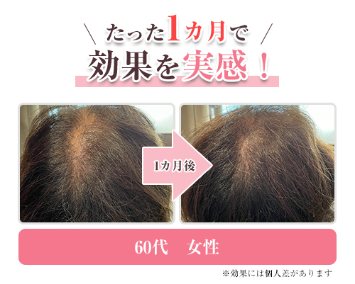 育毛③