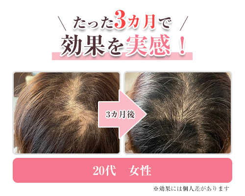 育毛④